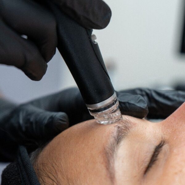 HydraFacial